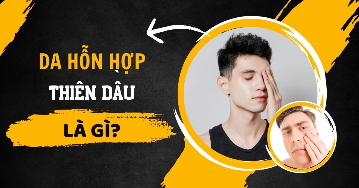 Da hỗn hợp thiên dầu là gì?