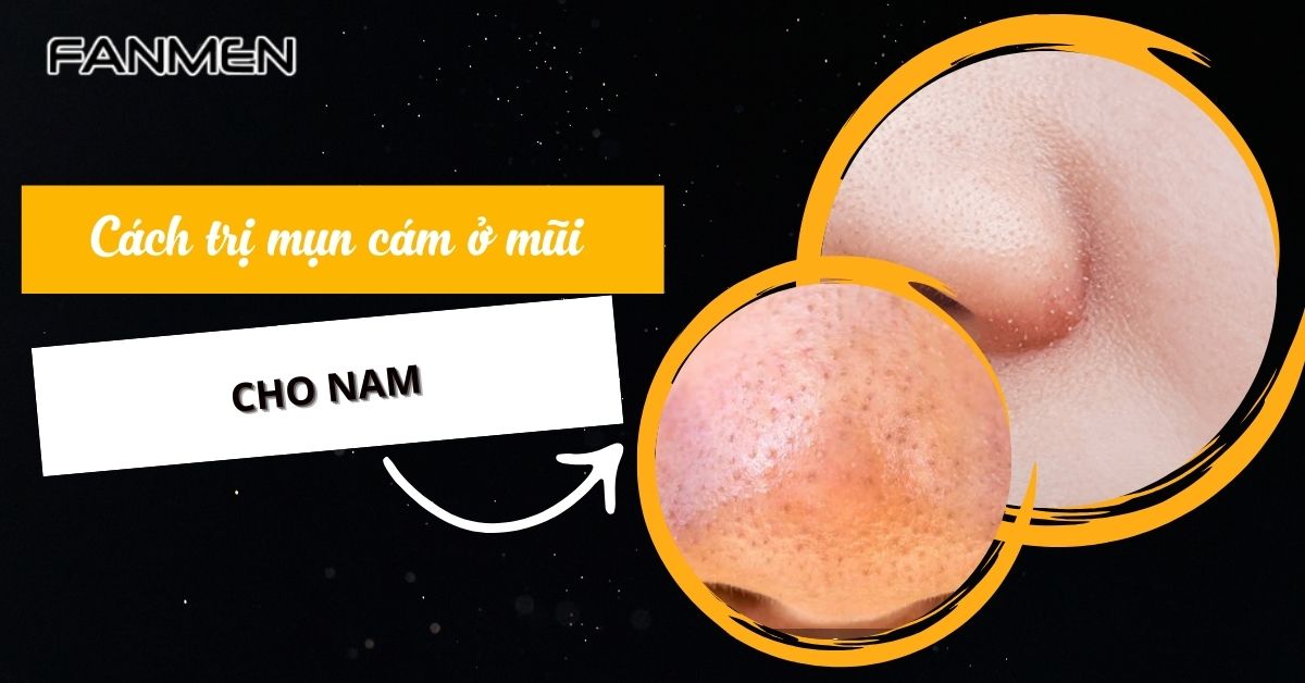 cach-tri-mun-cam-o-mui-cho-nam