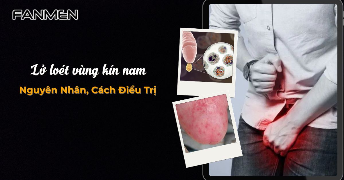 lo-loet-vung-kin-nam