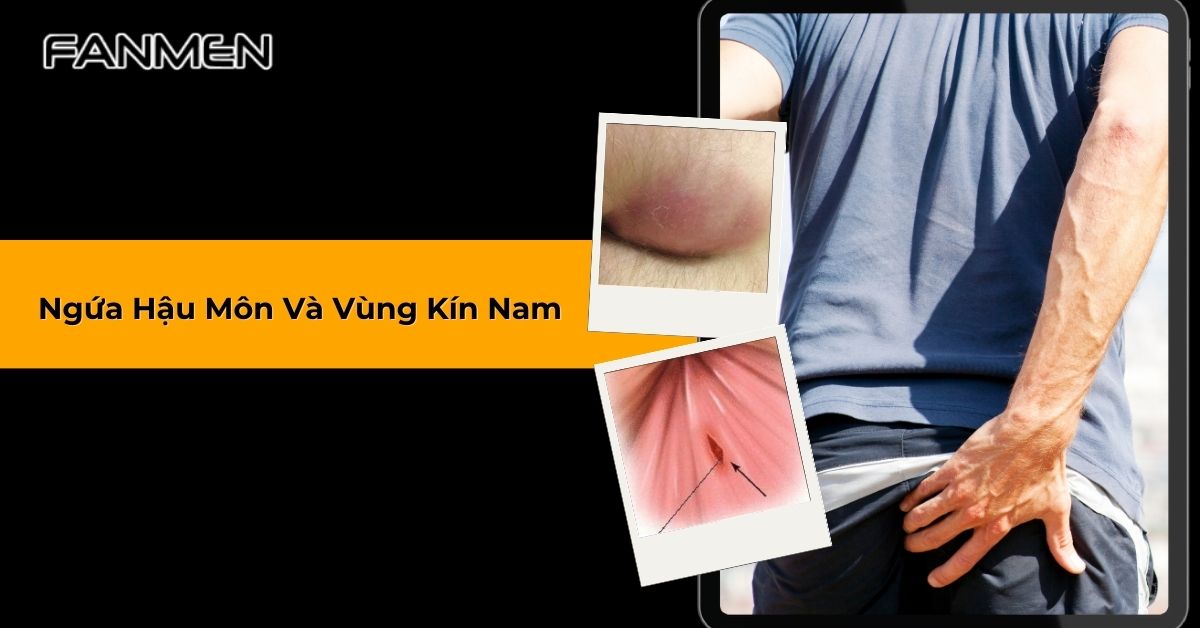 ngứa hậu môn và vùng kín nam
