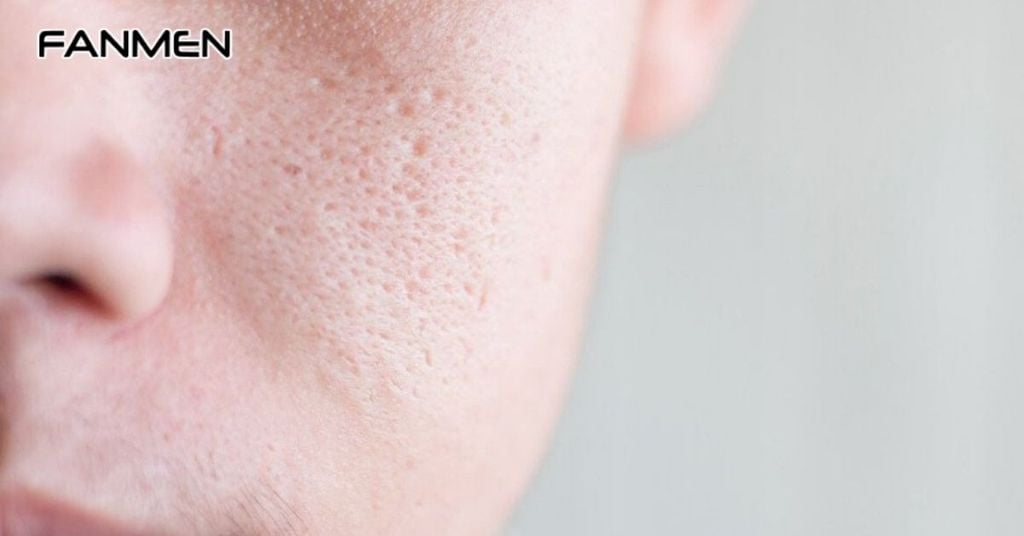 Cách chọn toner se khít lỗ chân lông phù hợp