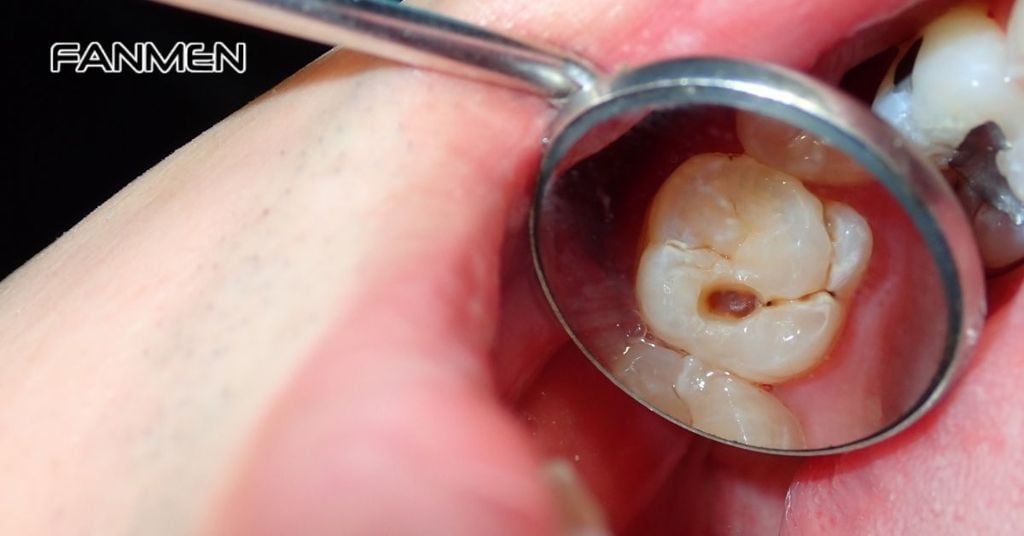 Bệnh lý về răng miệng