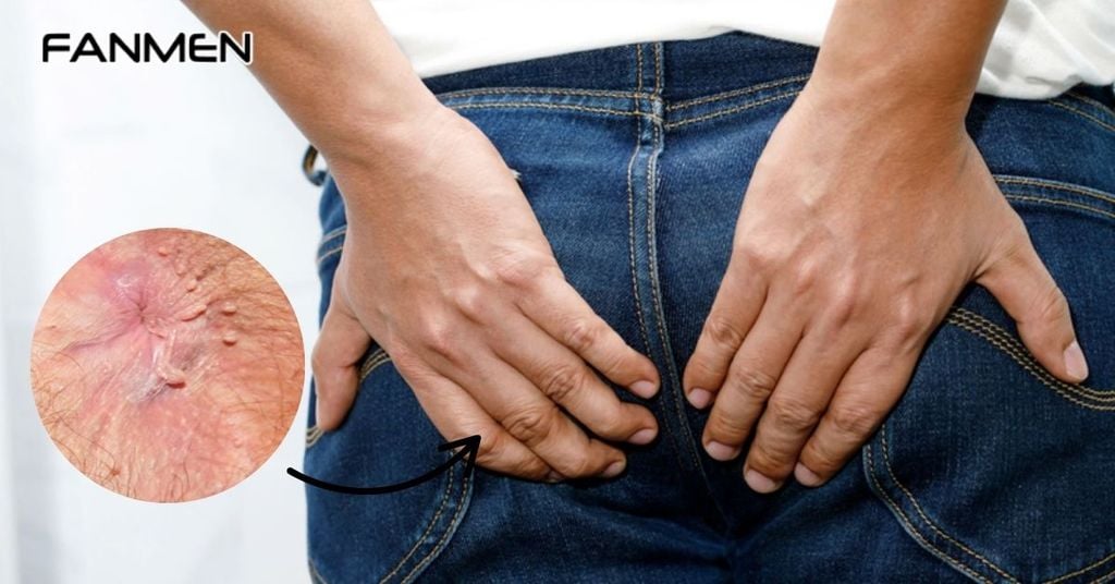 Do bệnh tình dục