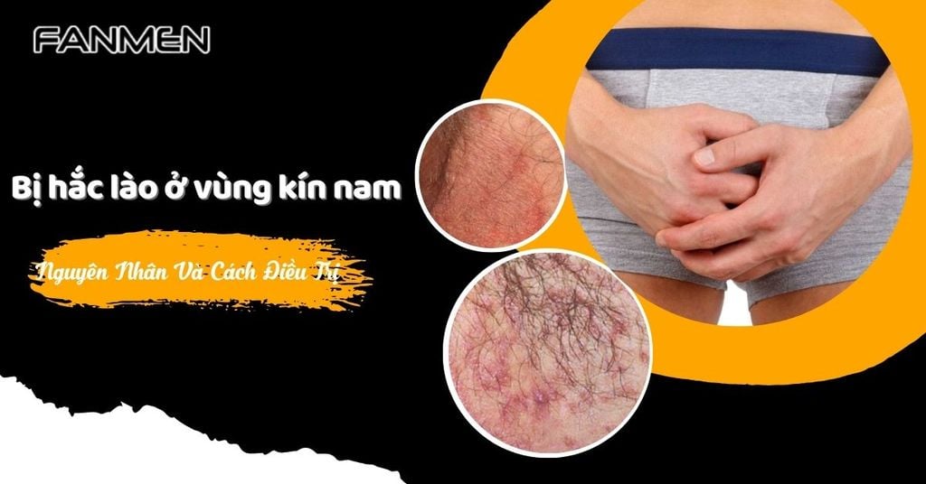 Bị hắc lào ở vùng kín nam