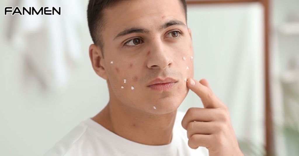 Hướng Dẫn Cách Sử Dụng Kem Trị Thâm Mụn Đúng Chuẩn