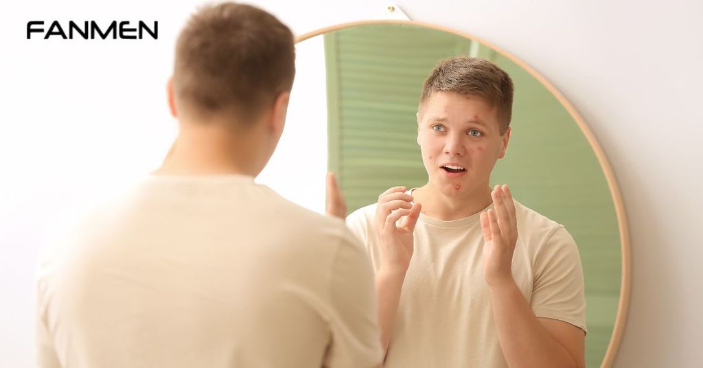 Các bước chăm sóc da cho tuổi dậy thì đơn giản, hiệu quả