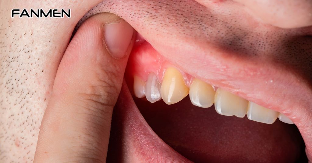 Các nguyên nhân từ khoang miệng