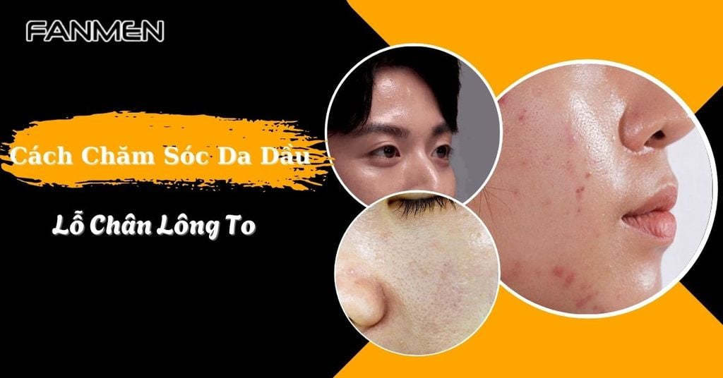 Cách chăm sóc da dầu lỗ chân lông to