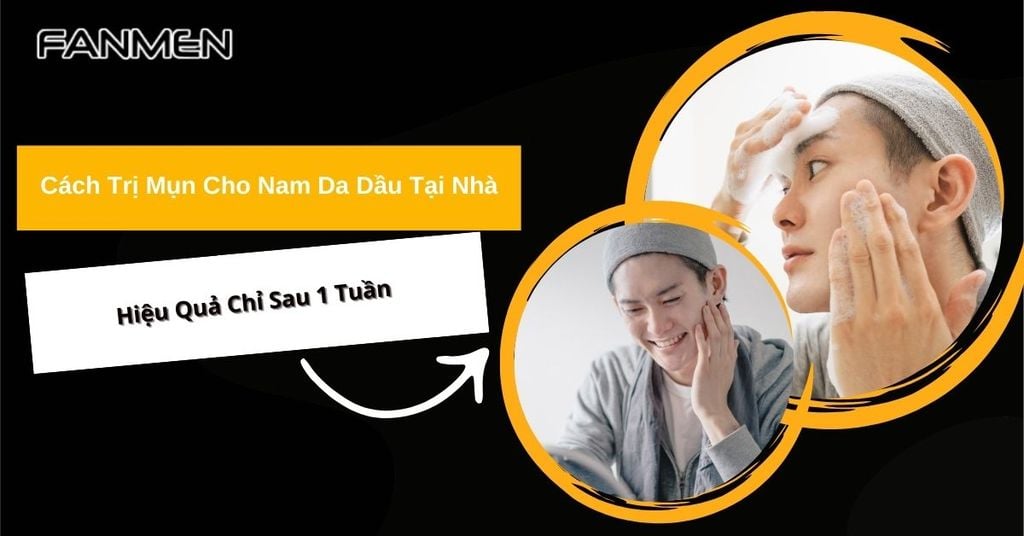 cách trị mụn cho nam da dầu tại nhà