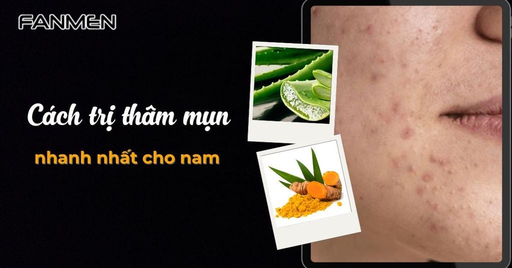 Cách trị thâm mụn nhanh nhất cho nam
