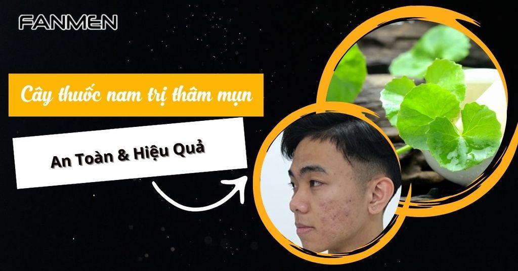Cây thuốc nam trị thâm mụn