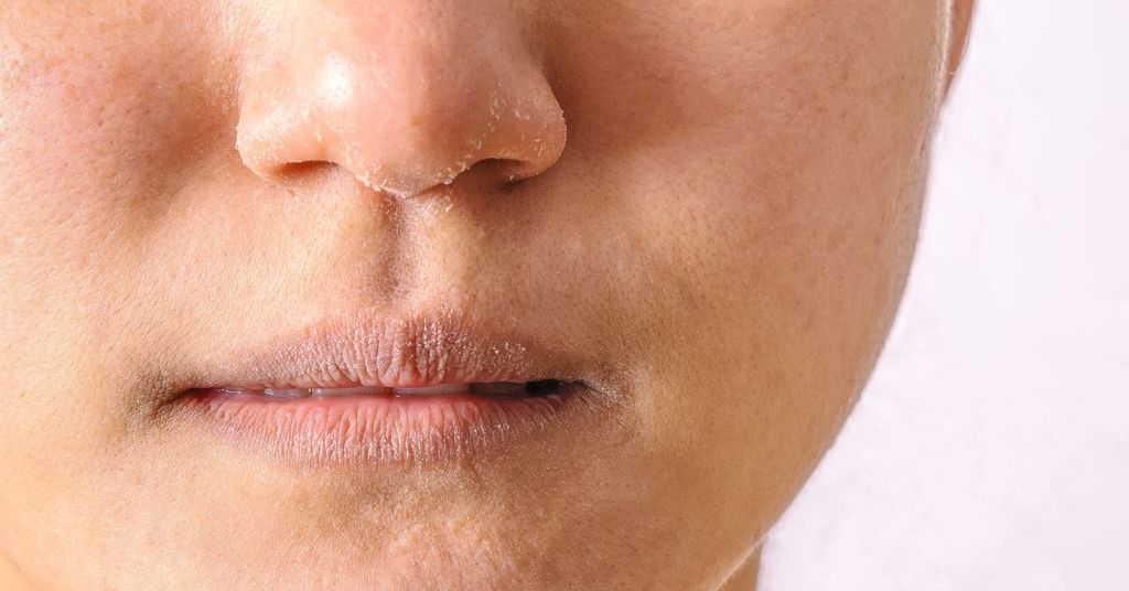 chăm sóc da dầu vào mùa đông