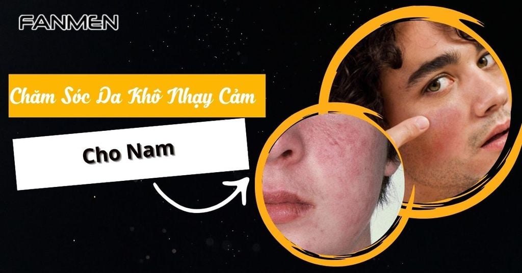 Da khô nhạy cảm