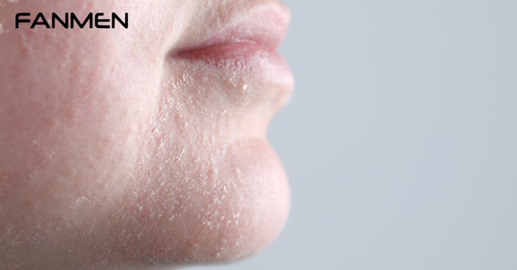 Cách phân biệt loại da nam giới