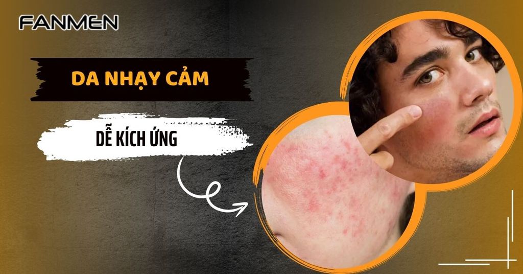 Da nhạy cảm dễ kích ứng