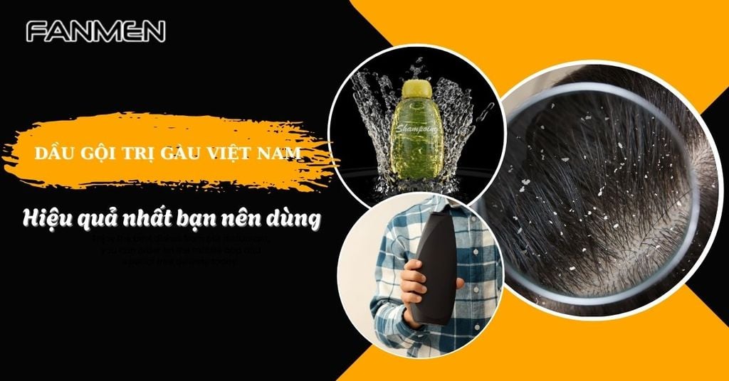 dầu gội trị gàu việt nam​