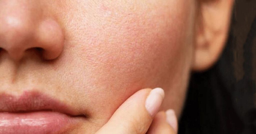 da nhạy cảm dễ kích ứng