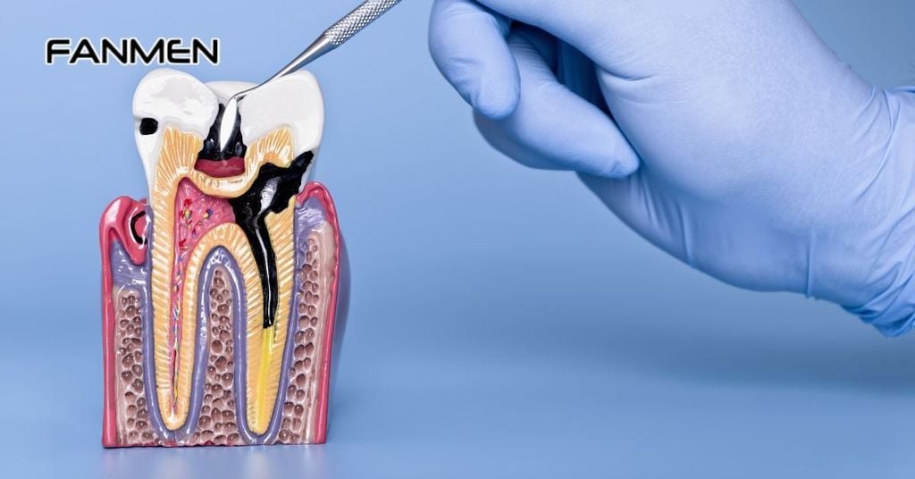 Điều trị sâu răng, viêm tủy