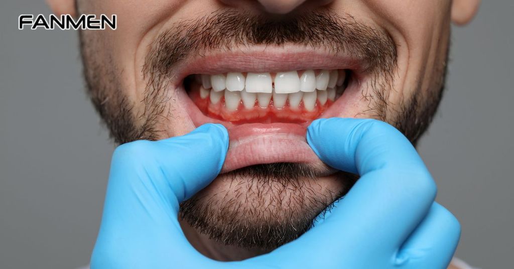 Do các vấn đề răng miệng từ trước
