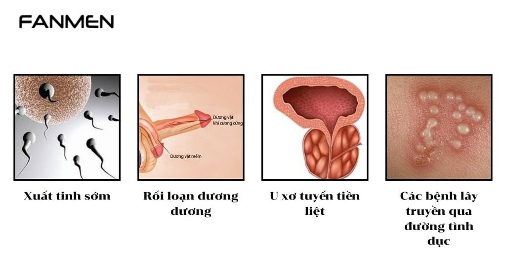 Một Số Bệnh Lý Thường Gặp Ở Vùng Kín Nam Giới