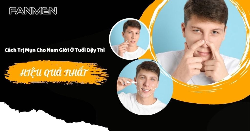 Cách trị mụn cho nam giới ở tuổi dậy thì