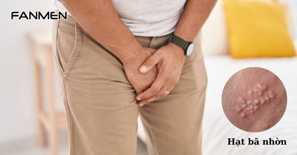 Hạt bã nhờn sinh dục