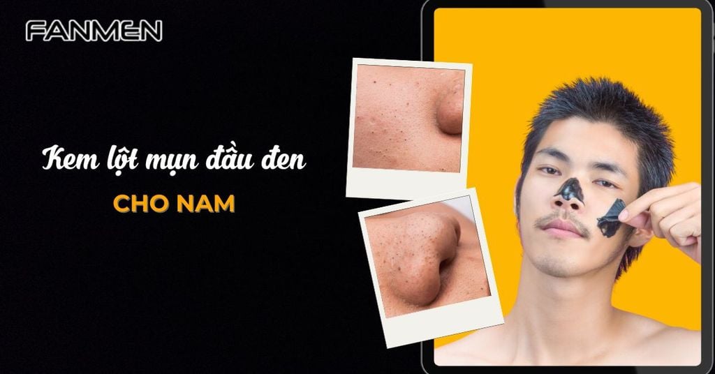 Kem lột mụn đầu đen cho nam