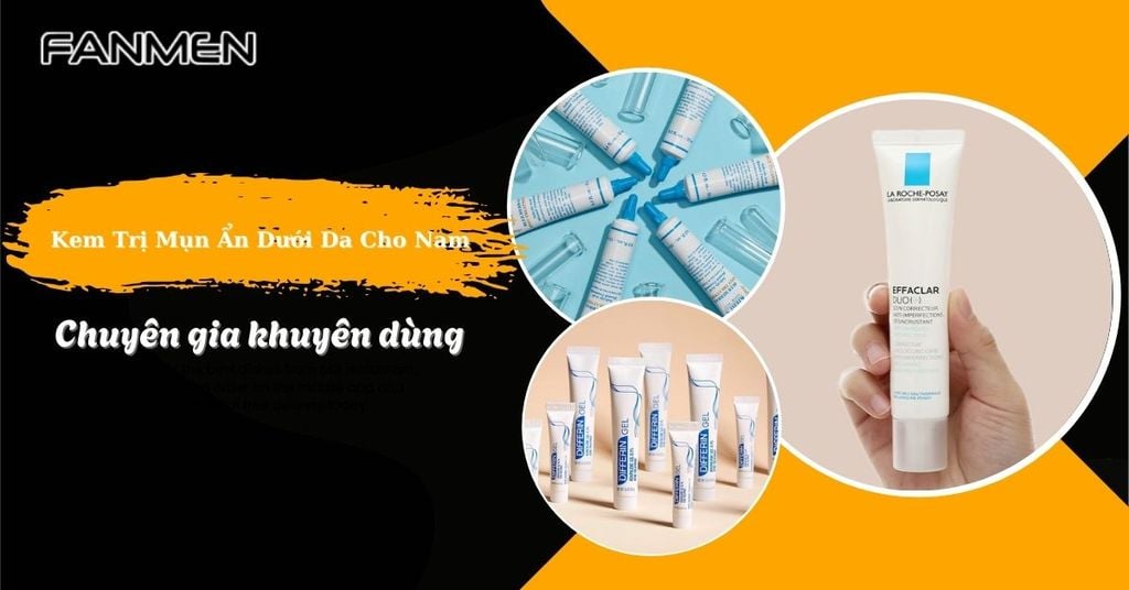 Kem trị mụn ẩn dưới da cho nam