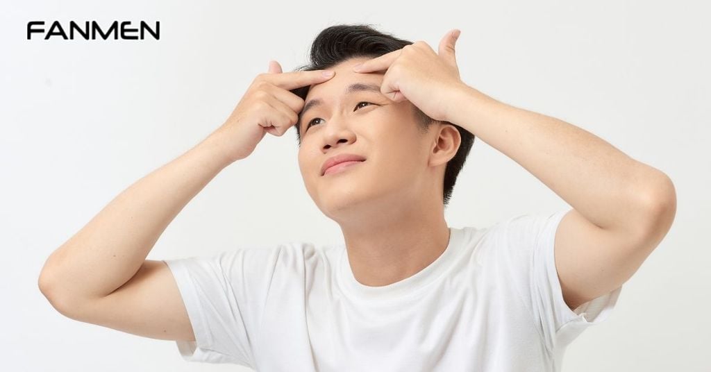 Không tự ý nặn mụn