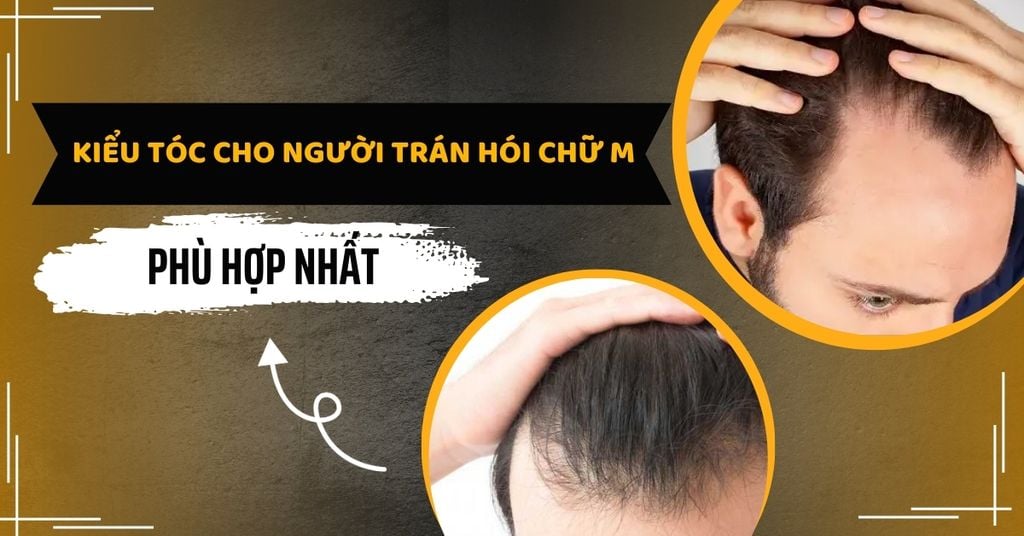 kiểu tóc cho người trán chữ M nam