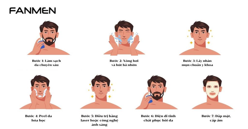 Liệu trình trị mụn cho nam chuyên sâu
