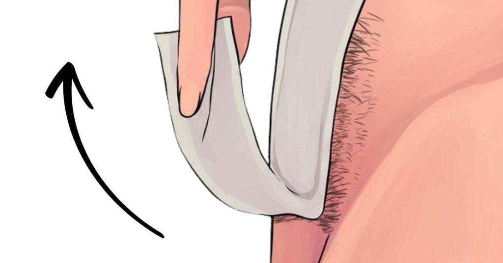 Cạo lông vùng kín cho nam bằng gel (waxing)