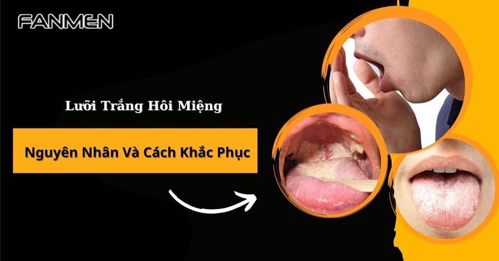Lưỡi trắng hôi miệng