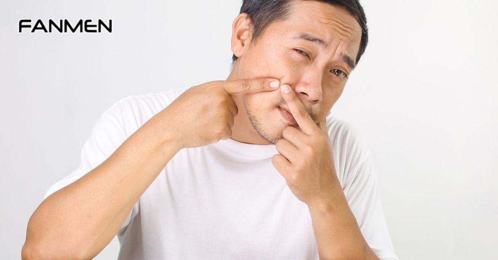 Vị trí mụn ở má