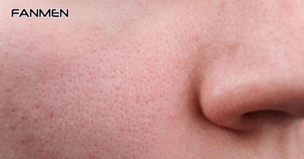 Nguyên nhân gây ra tình trạng da mặt nam giới bị khô​