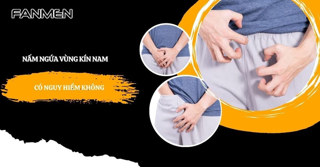 Nấm ngứa vùng kín nam