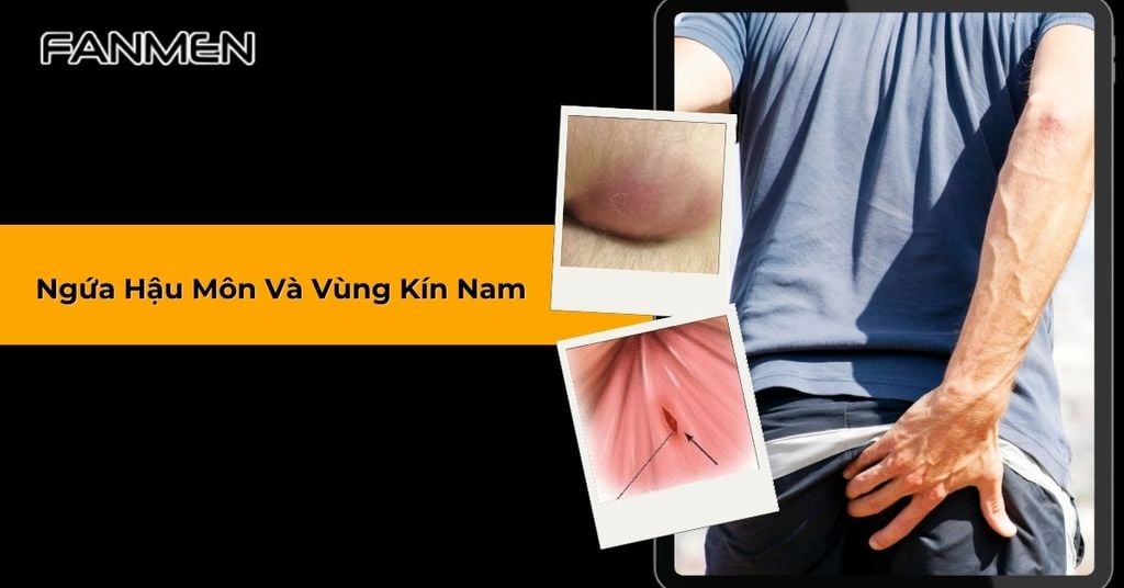 ngứa hậu môn và vùng kín nam