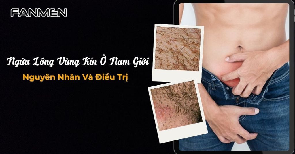 Ngứa lông vùng kín ở nam giới