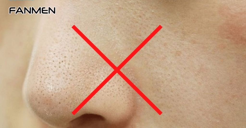 Hướng Dẫn Các Ngăn Ngừa Mụn Cám Ở Nam Giới Quay Trở Lại