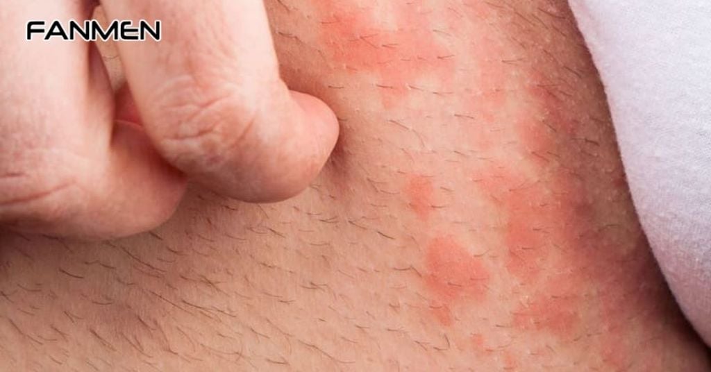 Bị Ngứa Vùng Kín Nam Có Nguy Hiểm Không?