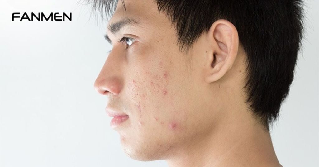 Nguyên nhân trực tiếp