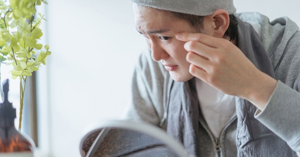 Da dầu và da nhạy cảm