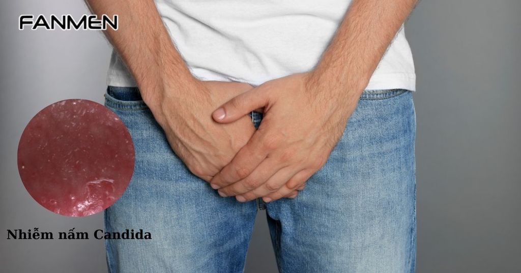 Nhiễm trùng nấm men