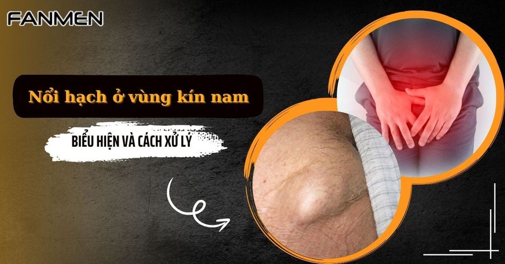 Nổi hạch ở vùng kín nam