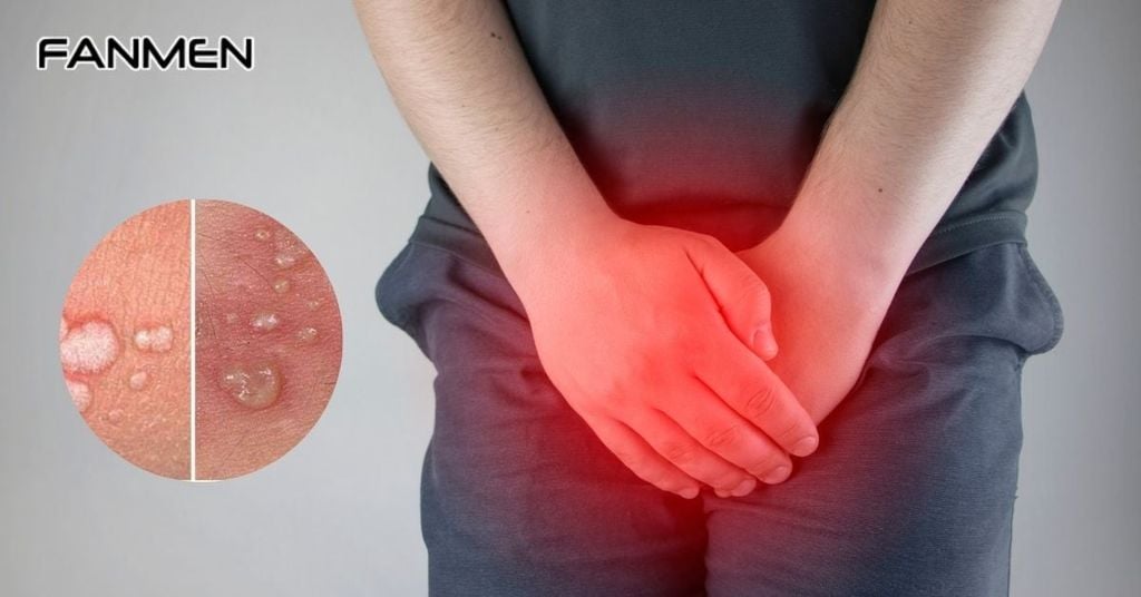 Nổi đốm trắng ở vùng kín nam có tự hết không