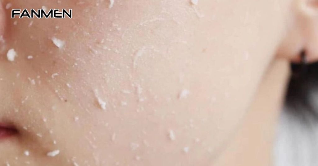 Dùng các sản phẩm tẩy tế bào chết chứa AHA và BHA