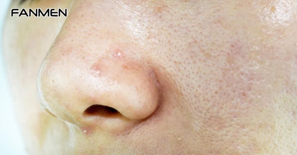 Cách Lựa Chọn Sản Phẩm Chăm Sóc Da Dầu Lỗ Chân Lông To Ở Nam Giới