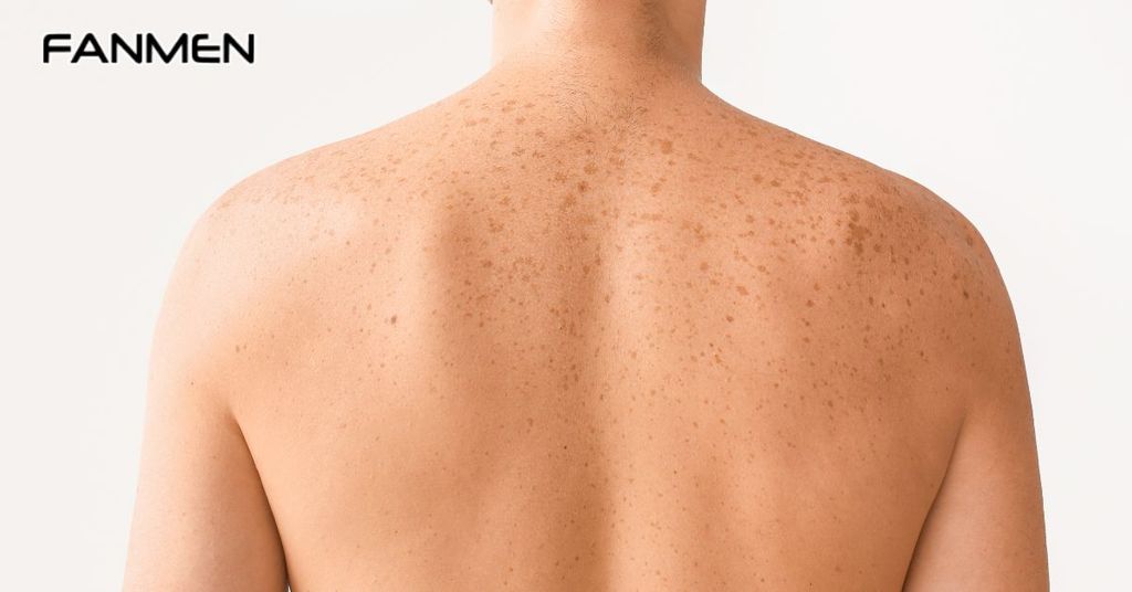 Tác hại của tắm trắng da đối với cơ thể