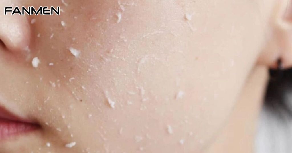 Tẩy tế bào chết