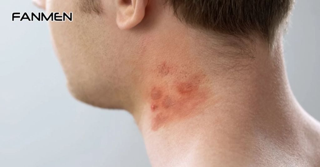 Sự thay đổi của hormone